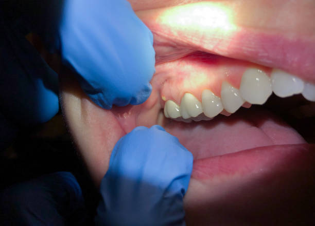 Best Same-Day Emergency Dentist in Springfield, NE