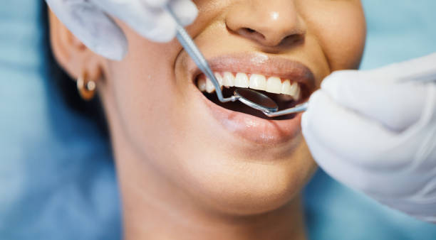 Best Emergency Wisdom Teeth Removal in Springfield, NE